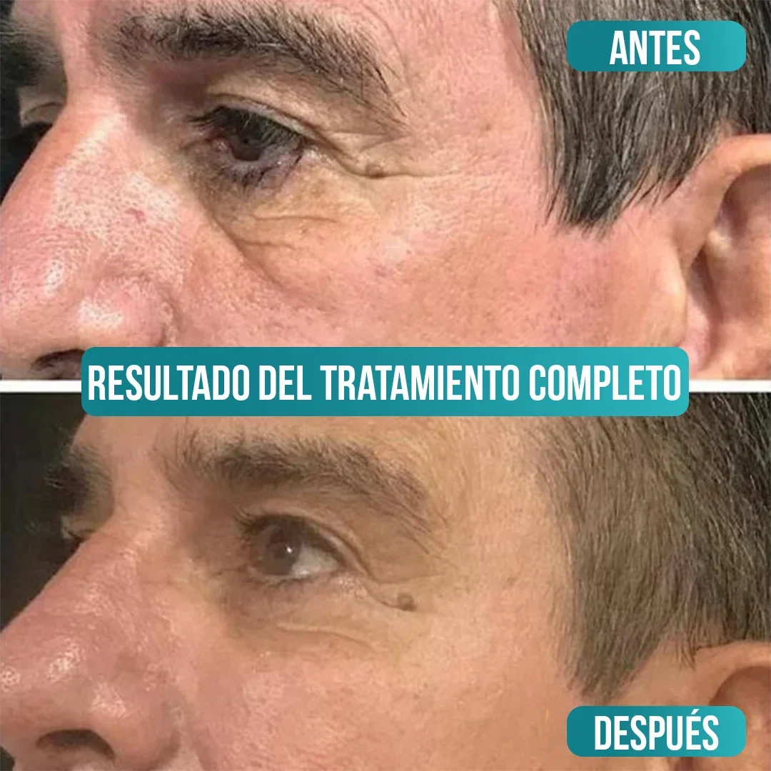 Crema Antiedad de Colágeno para Hombres - Veze Men