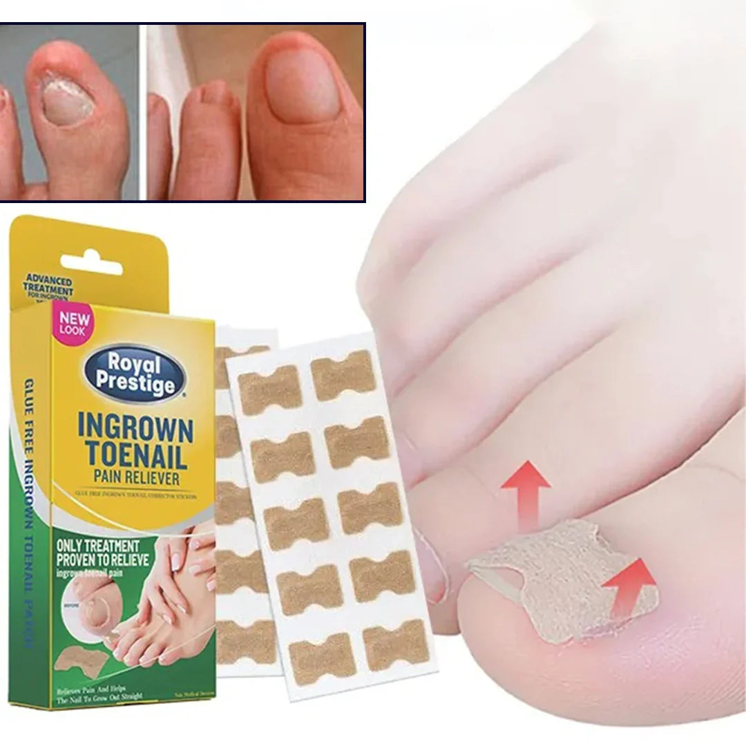(PIDE 10 y LLEVA 20) Parches Para Hongos y Uñas Encarnadas - Encravax