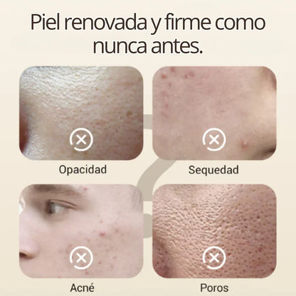 Hidratación, Claridad y Renovación con ClariSkin 75g – Tu Piel Más Joven y Uniforme. [Uso nocturno]